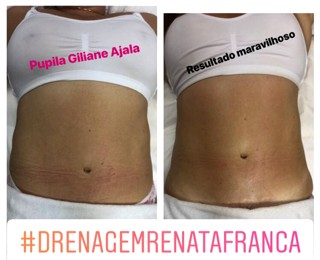 Drenagem Linfática Itajaí - Giliane Ajala